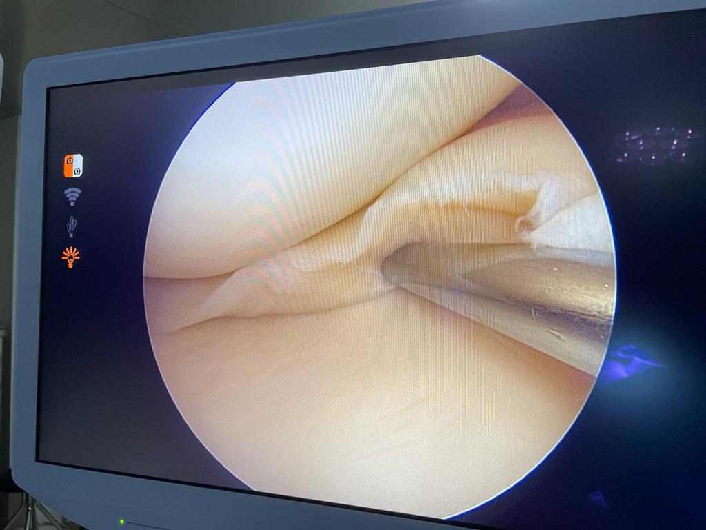 xray image