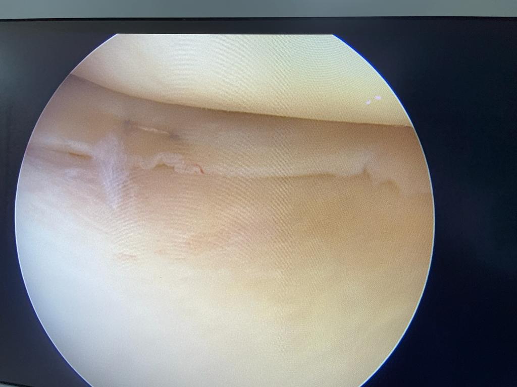 xray image